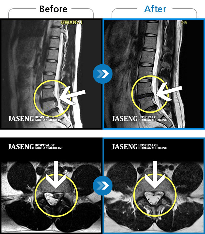 λڻѹ溴 ġ MRI  ġ- 㸮  ,  ٸ    ϼ̽ϴ.