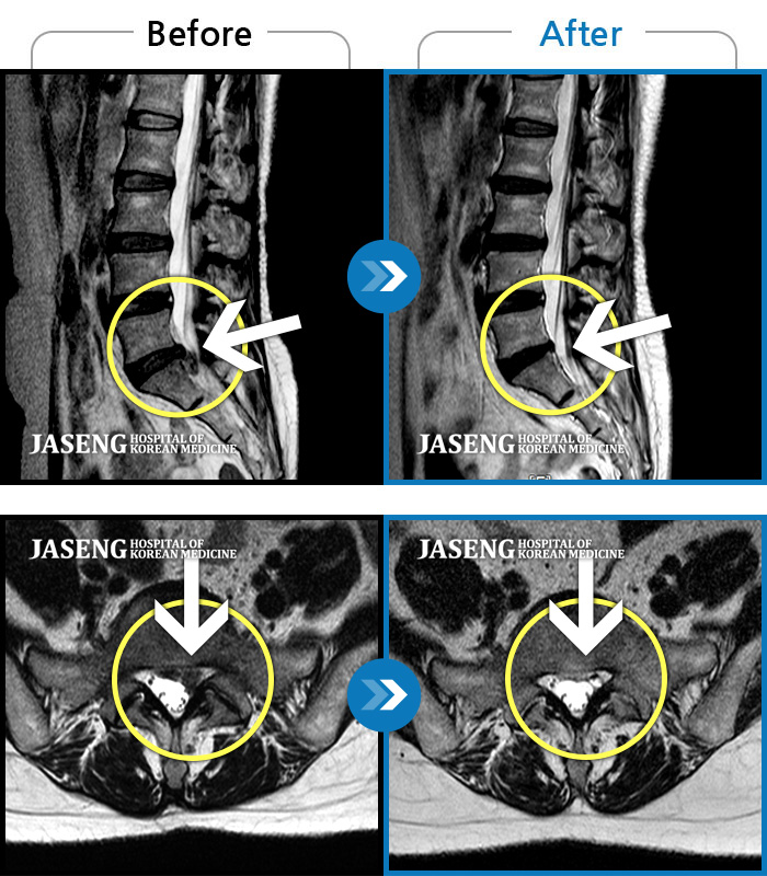 ڻѹ溴 ġ MRI  ġ-  ŵ Ұ · Ͻ ȯںԴϴ.