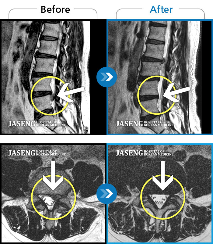 ڻѹ溴 ġ MRI  ġ-2023.12濡 濡 ȴٰ ߲  ߻ 㸮   Դϴ.