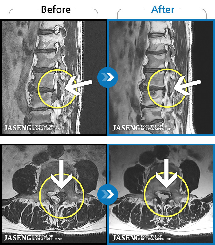 �ڻ��ѹ溴�� ġ���� MRI�� ���� ġ����-�㸮 ���� �� ���� ��� ������ ���Ͽ� �ϻ��Ȱ�� ������ ���¿����ϴ�.