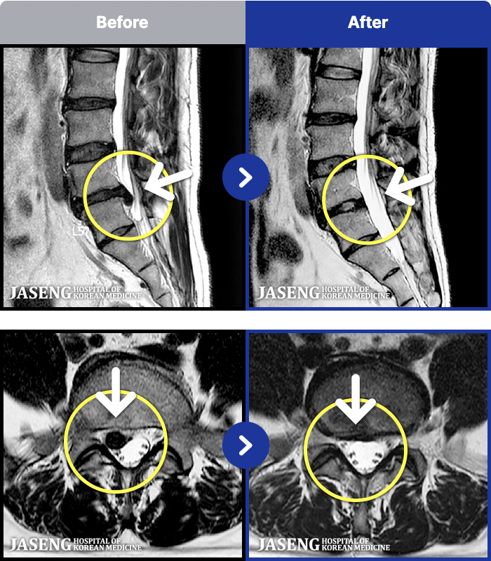 �ڻ��ѹ溴�� ġ���� MRI�� ���� ġ����-�㸮 ����� ������ ������ ���Ƹ� �ٱ������� ������ ������ �̻��ϰ�, �ٸ��� ��� �����