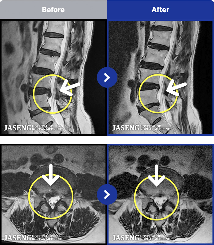 �ؿ���ڻ��ѹ溴�� ġ���� MRI�� ���� ġ����-�ؽ��� ���� �� ������������� ������ ����� �ϻ��Ȱ�� �Ұ����� ���·� �����ϼ̽��ϴ�.