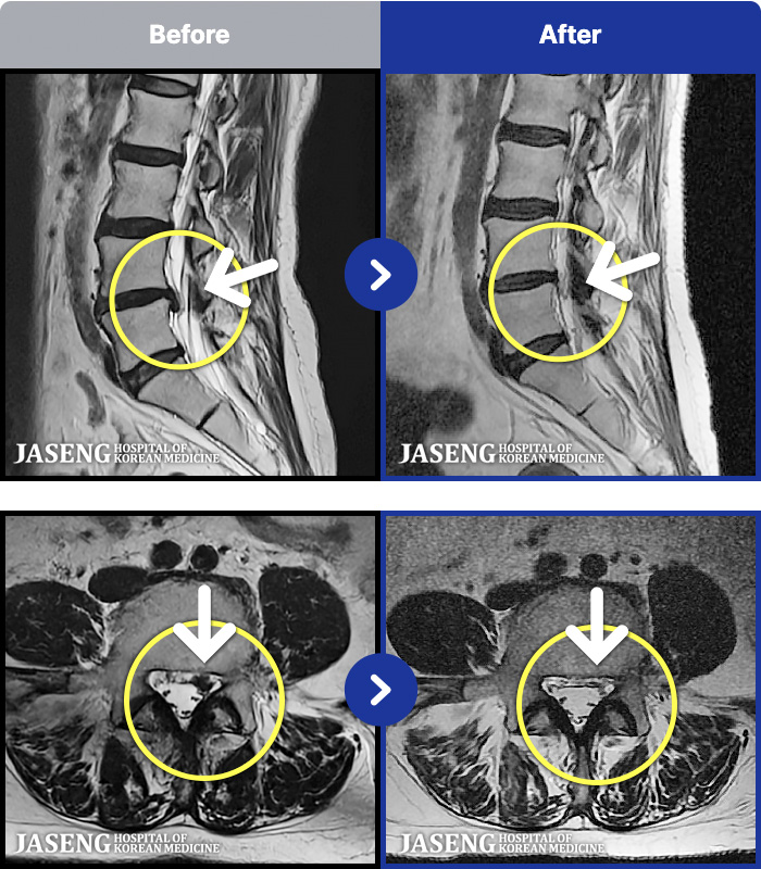 �ڻ��ѹ溴�� ġ���� MRI�� ���� ġ����-���� �㸮, ��� ������ ���� ����� �� ��������, �߸� ���� �ٷ����Ϸ� �ϻ��Ȱ �Ұ���