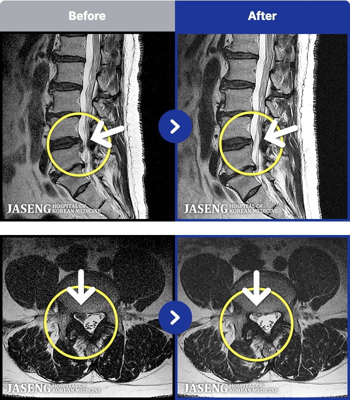 �ڻ��ѹ溴�� ġ���� MRI�� ���� ġ����-���� �㸮 ��� ����. ���� ���� �����, ���� ���� �ٷ����Ϸ� �ϻ� ��Ȱ �Ұ���.