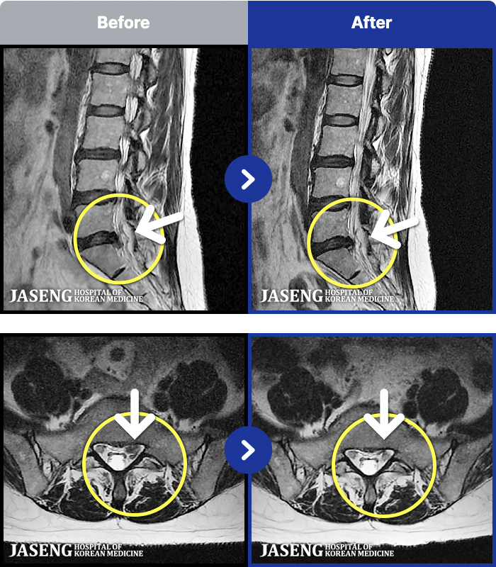 �ڻ��ѹ溴�� ġ���� MRI�� ���� ġ����-���� �кο� �ٸ��� ������ �ٸ� �ٷ����Ϸ� ����Ÿ�.