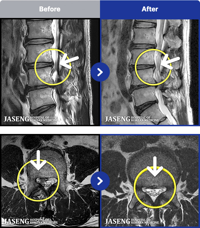 �ڻ��ѹ溴�� ġ���� MRI�� ���� ġ����-���� �㸮 ������ ���� ����� ���� 
