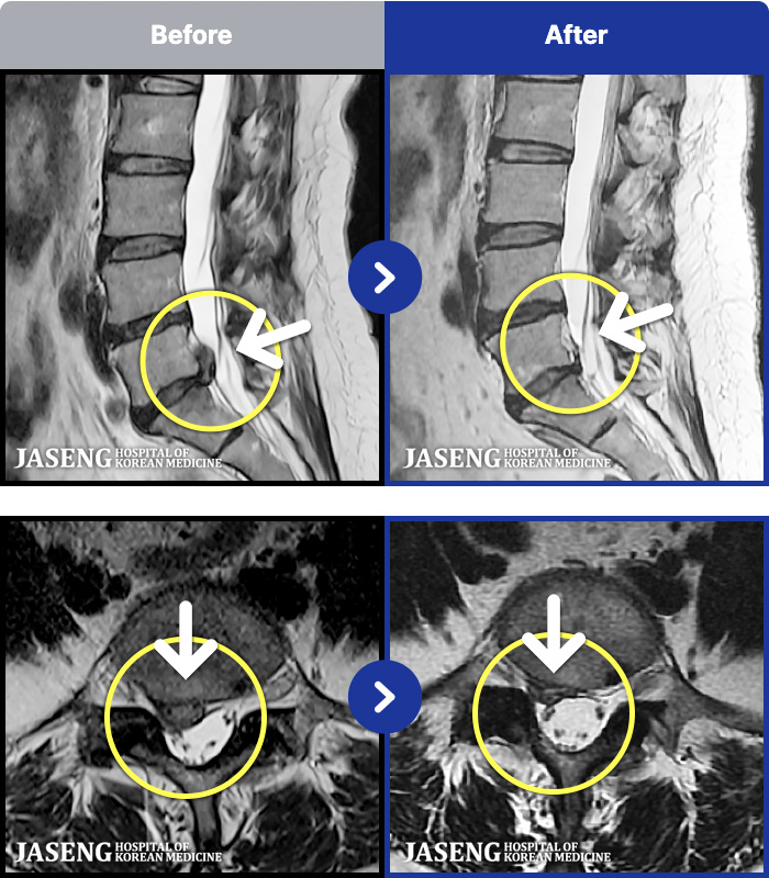 �ڻ��ѹ溴�� ġ���� MRI�� ���� ġ����-�㸮 ����� ���ſ����ϰ� ������ ������ �ٸ��� ������ �ִ�.