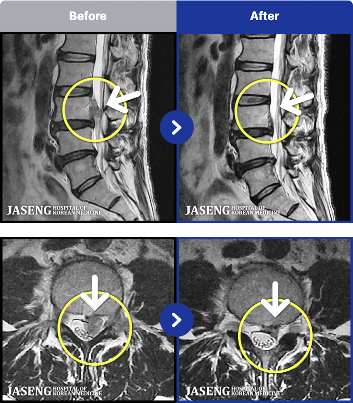 �ڻ��ѹ溴�� ġ���� MRI�� ���� ġ����-���� �㸮, ��� �ĸ� ������ ������ ������ ���� ����