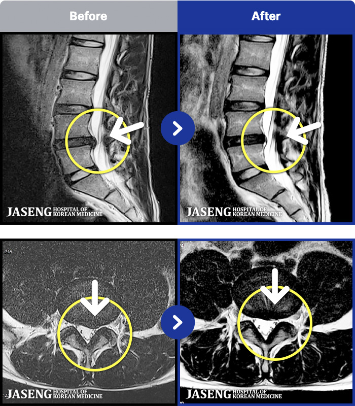 �ڻ��ѹ溴�� ġ���� MRI�� ���� ġ����-�㸮 ���� ����� ������ ��ħ�� �� �㸮 ������ �����ߴ�.