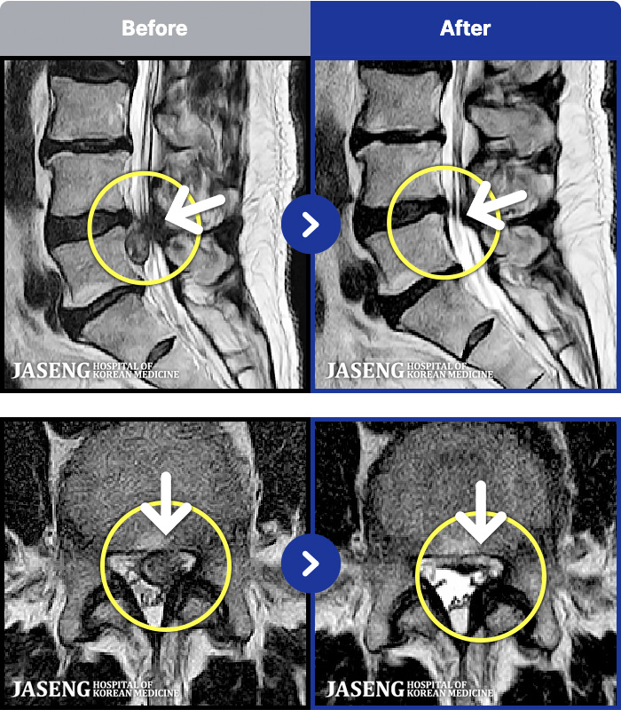 �ڻ��ѹ溴�� ġ���� MRI�� ���� ġ����-�����㸮 ��� ������ �ؽ��ϰ� ���� �ٸ��� ������ ���ؼ� �߹ٴڱ��� ����