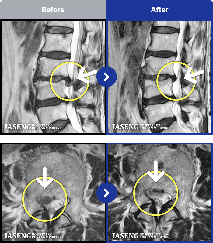 �����ڻ����ǿ� ġ���� MRI�� ���� ġ����-�ϻ��Ȱ �� �߻��� �㸮 ������ ���� �ٸ� ���� ����