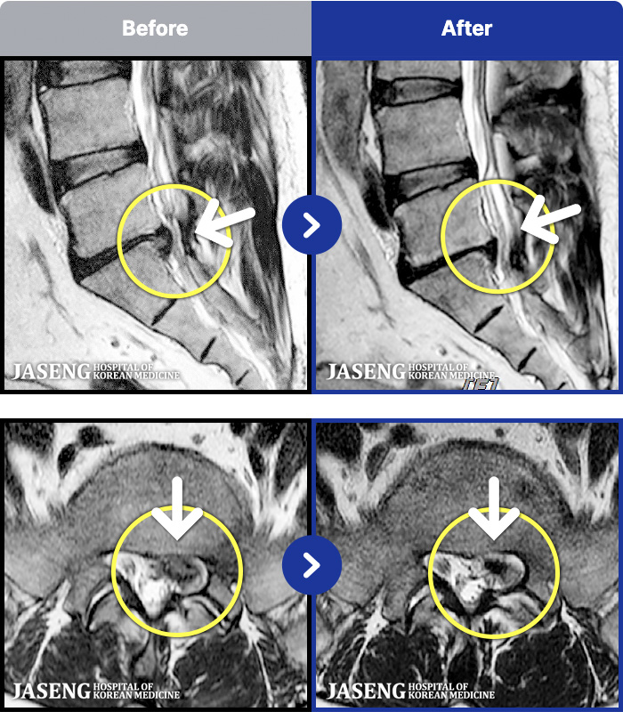 �����ڻ����ǿ� ġ���� MRI�� ���� ġ����-�׻� ��ũ�� �����Ͽ����ϴ�.