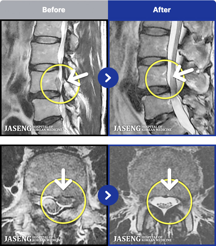 �����ڻ����ǿ� ġ���� MRI�� ���� ġ����-���� ����������� ���Ͽ� ��ü� Ÿ�� �����Ͽ����ϴ�.