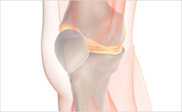 분당자생한방병원 무릎질환 무릎점액낭염-무릎점액낭염 관련 사진 입니다.