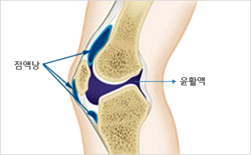 분당자생한방병원 무릎질환 무릎점액낭염-점액낭과 윤활액이 위치해 있는 무릎 설명 이미지